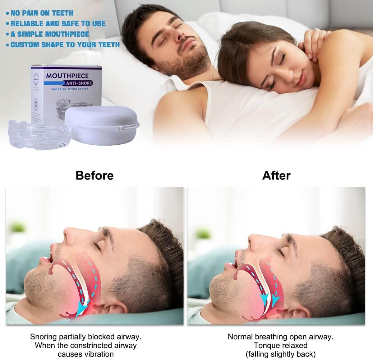 Before-and-after comparison of a man sleeping with and without a snoring mouth guard, showing improved airflow and reduced airway obstruction. Top of the image features a couple sleeping peacefully with product packaging in the background.